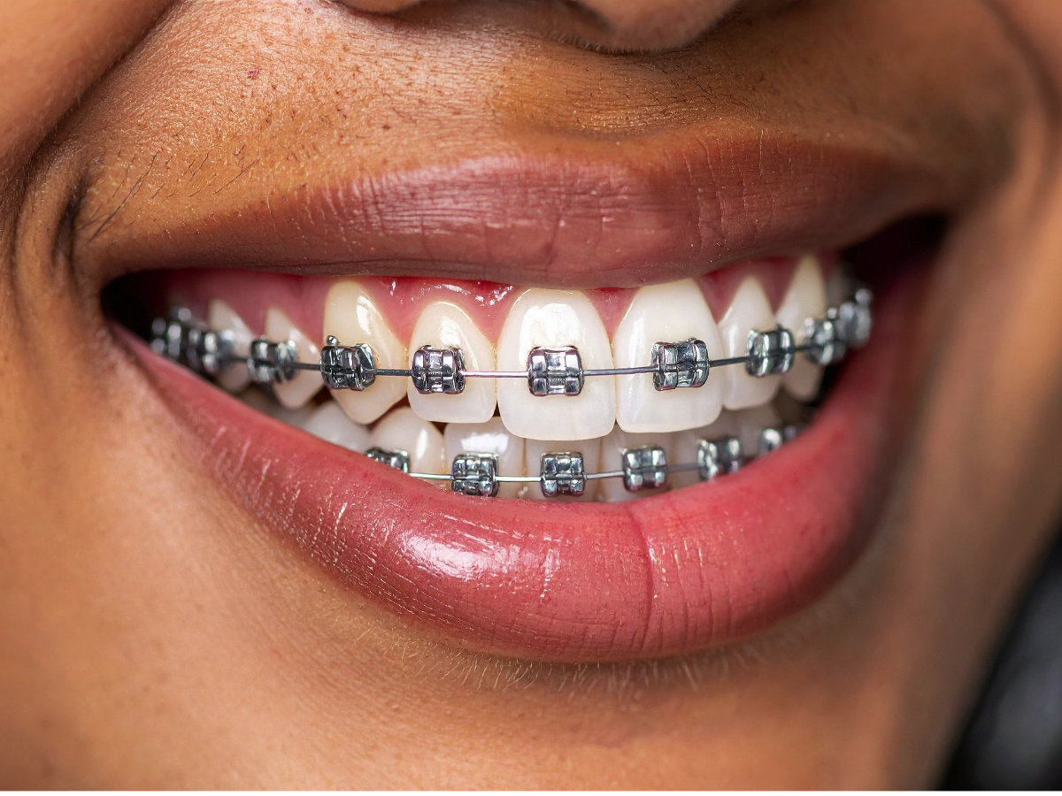 Orthodontics & Dentofacial Alignment at Natana Dental